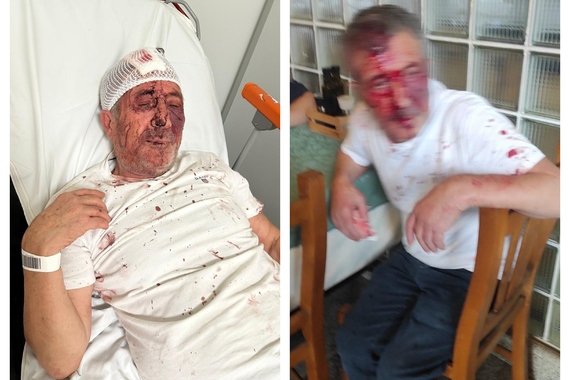 'U medijima su izašle netočne i maliciozne informacije. Postupali smo u samoobrani. Ispričavamo se građanima'