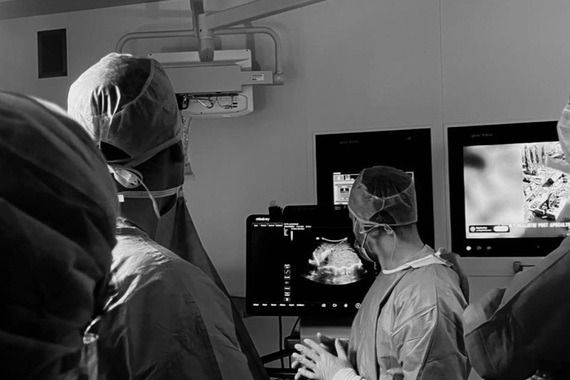 Opća bolnica Pula prvi puta izvela intraoperativnu termalnu ablaciju metastaze u jetri