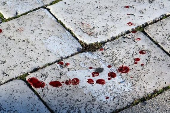 Uređivao Slovencu okućnicu, pa ga istukao zbog neplaćenih radova