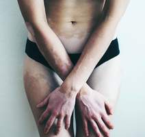 Marina Ćorić, serija The Skin I Live In , kategorija Akt – Tijelo, 1. mjesto